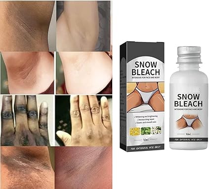 Snow Bleach Intensive Cream – Dark Spot & Underarm Whitening Treatment