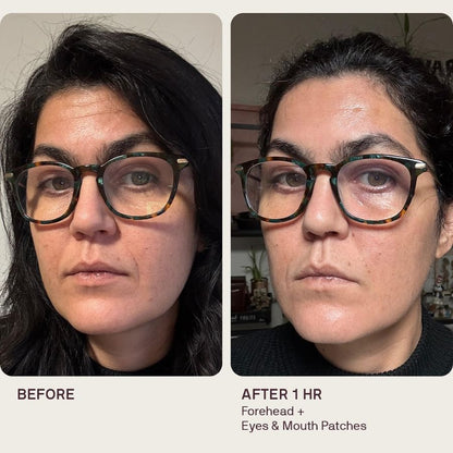Anti-Wrinkle Patches 2.0 | All-in-one