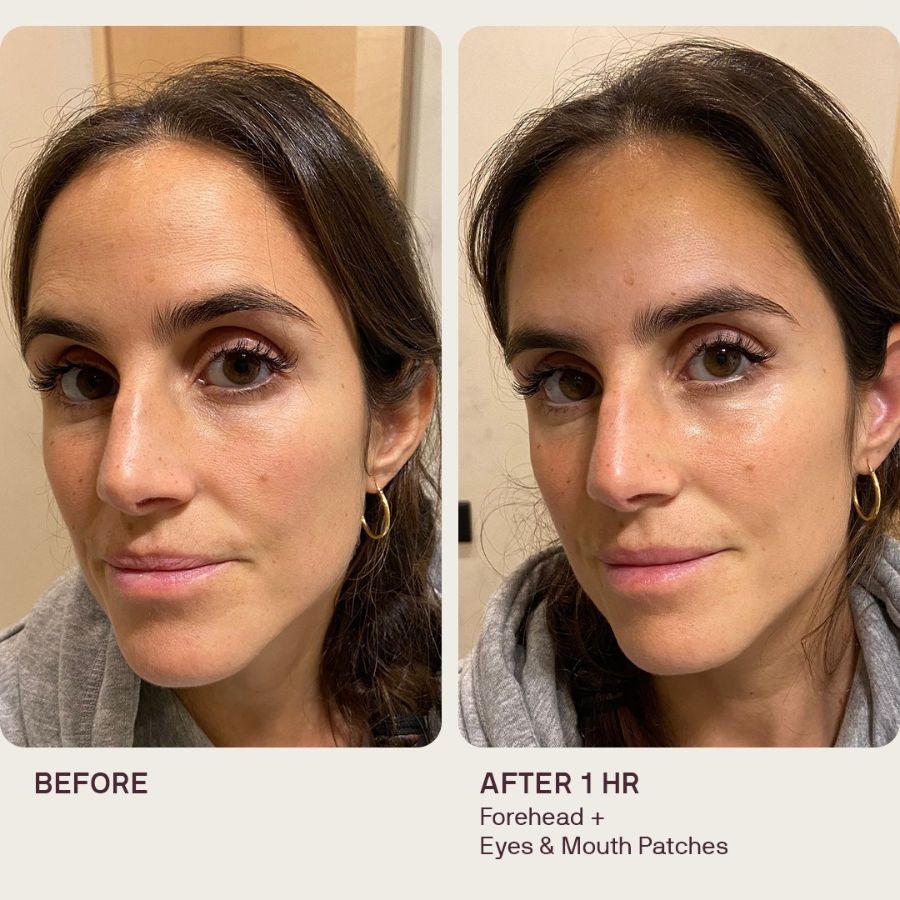 Anti-Wrinkle Patches 2.0 | All-in-one