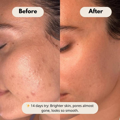 Peel Shot Glow Duo: White Rice Brightening & Black Rice Refining Ampoules (Buy 1 Get 1 Free)