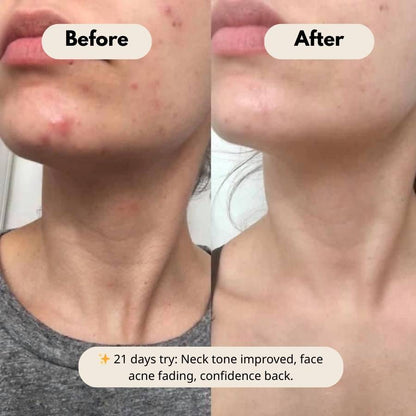 Peel Shot Glow Duo: White Rice Brightening & Black Rice Refining Ampoules (Buy 1 Get 1 Free)