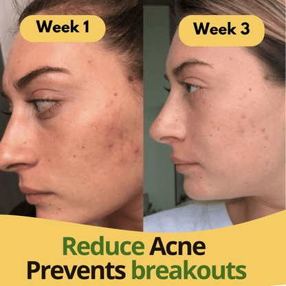 Turmeric & Kojic Acid Pads