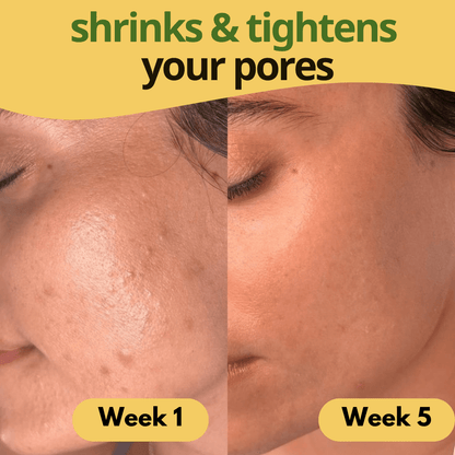 Turmeric & Kojic Acid Pads