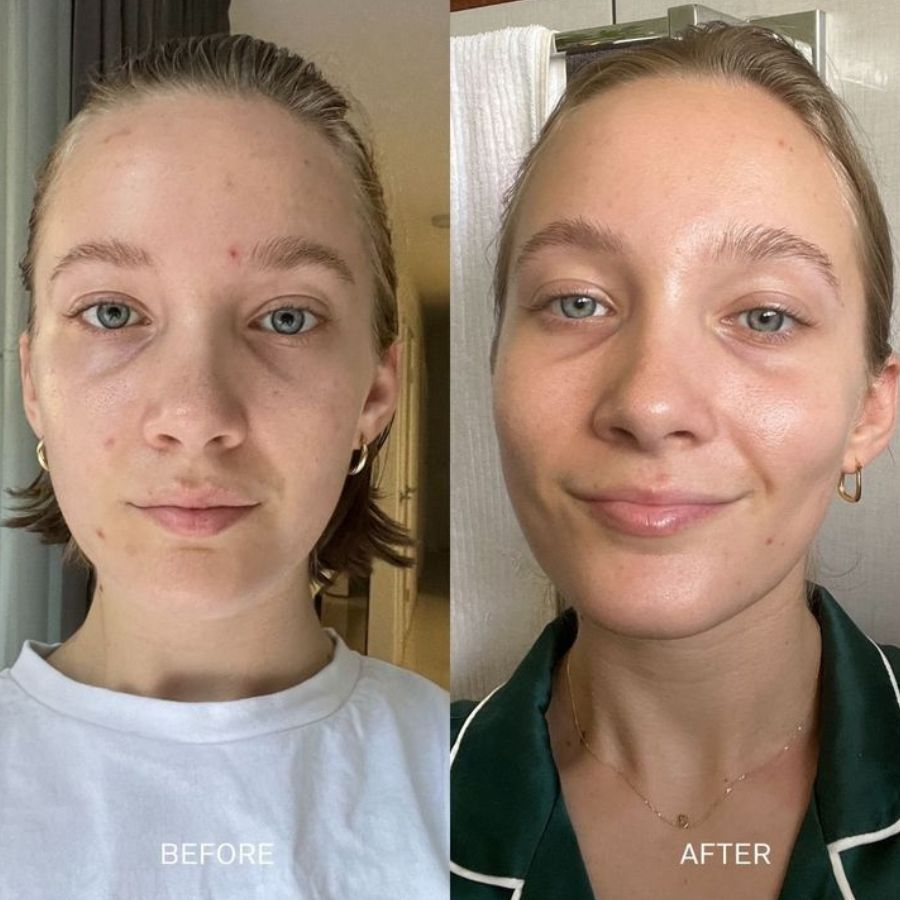 White Truffle First Spray Serum